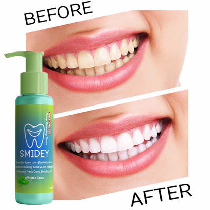 SMIDEY Dentifrice Blanchissant Détachant Intensif