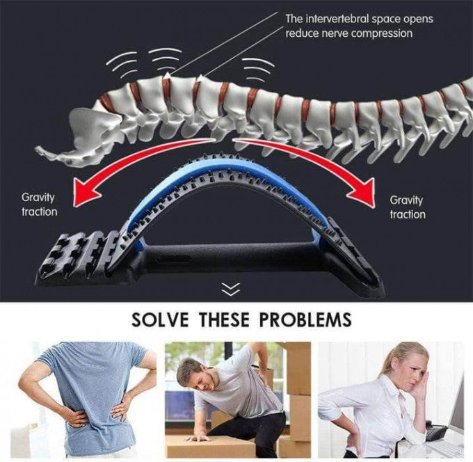 Support dorsal magique BACK STRETCHER, dispositif de correction de posture pour civière dorsale pour le soulagement des maux de dos avec support dorsal